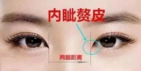 最新双眼皮法，重塑美丽双眸的艺术